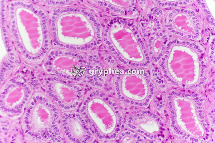 Thyroïde normale x100 - gryphea.com